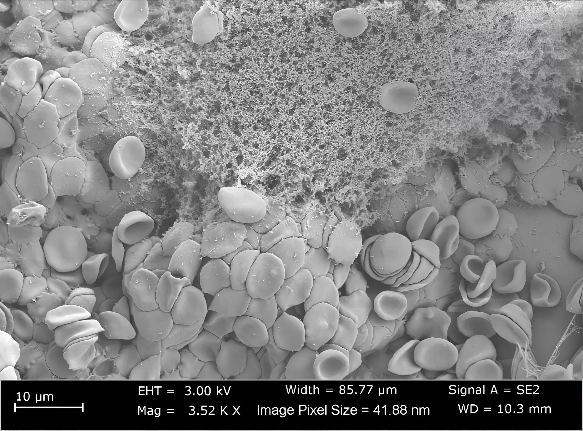 HemoSeal – Xốp cầm máu 100% Chitosan